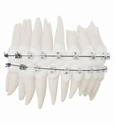 Image result for Empower Braces