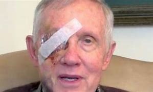 Image result for Harry Reid Treadmill Accident
