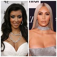 Image result for Kim Kardashian Before After Veneers