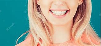 Image result for Beautiful Teeth Smile