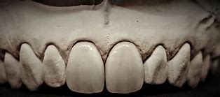 Image result for Dental Lab Pressvest