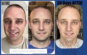 Image result for SeneGence Skin Care Before and After