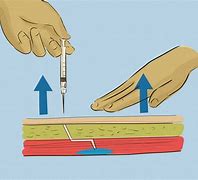 Image result for Intramuscular Injection Procedure