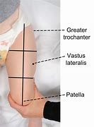 Image result for Intramuscular Injection Thigh