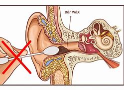 Image result for How to Clean Ears