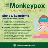 Image result for WHO monkeypox emergency