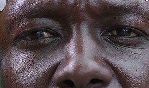 Image result for Black Man Nose