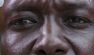 Image result for Black Man Nose
