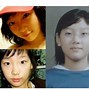 Image result for Chloe Ting Before Plastic Surgery