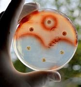 Image result for Superbug Antibiotic