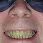 Image result for Funny No Teeth