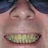 Image result for Clean Teeth Clip Art