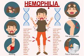 Image result for Medical Pictures of Hemophilia