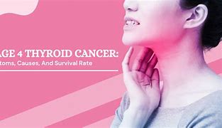Image result for Stage 4 Thyroid Cancer