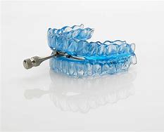 Image result for Oral Appliance for Sleep Apnea