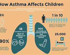 Image result for Levels of Asthma