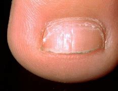 Image result for Dents On Skin