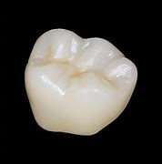 Image result for Zirconia Crown