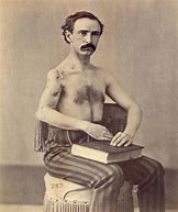 Image result for Injured Civil War Soldiers