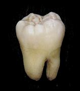 Image result for Tooth Drawing