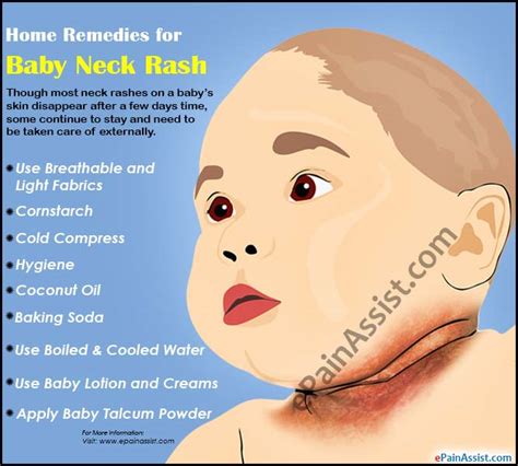 Causes & Home Remedies for Baby Neck Rash