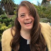Image result for Down Syndrome in Adults