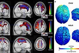 Image result for Child vs Adult Brain