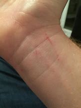 Image result for Battle Scars Cuts
