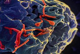 Image result for Ebola Infected Person