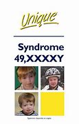 Image result for 49 XXXXY Chromosone