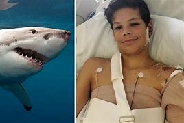 Image result for Attacked by Shark