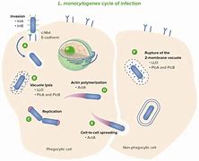Image result for Listeria Infection