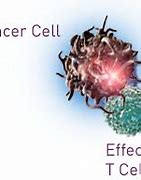 Image result for Stage 4 Cancer Meaning