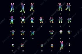 Image result for Male with Klinefelter Syndrome Karyotype