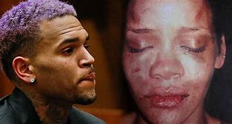 Image result for Rihanna Beat Up Face