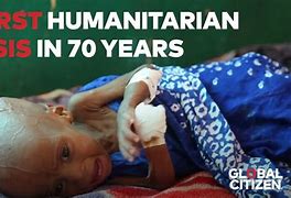 Image result for Yemen Humanitarian Crisis