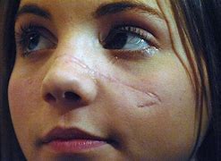 Image result for Woman with Battle Scars