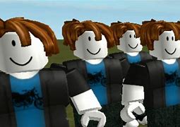 Image result for Bacon Hair 1