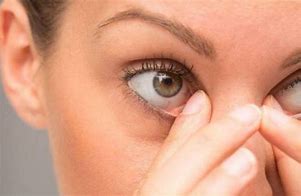 Image result for Woke Up with Swollen Eye