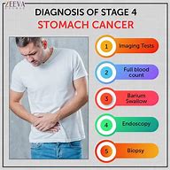 Image result for Stage 4 Stomach Cancer Prognosis
