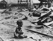 Image result for Radiation Burning in Japan Atomic Bombing