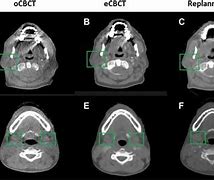 Image result for CT Cone Beam 3D Imaging