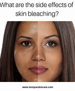 Image result for Skin Bleaching Cream Side Effects