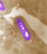 Image result for Listeria Catalase