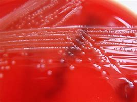 Image result for Listeria Monocytogenes On Blood Agar