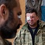 Image result for Russian Troops Ukraine Frostbite