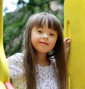 Image result for Asian Down Syndrome