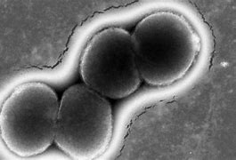 Image result for New Gonorrhea Superbug