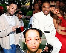 Image result for Chris Brown Face After Fight