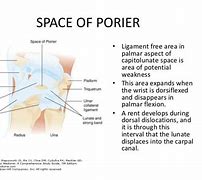 Image result for Space of Poirier